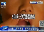 追踪：武汉半岁宝宝被恶犬咬穿头骨 需做开颅手术 - 新浪湖北