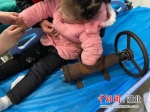 湖北一女童左手被“咬”断多截 手术8小时保住了 - Hb.Chinanews.Com