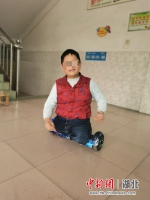 平衡车上的无腿男孩：用坚强乐观面对磨难 - Hb.Chinanews.Com